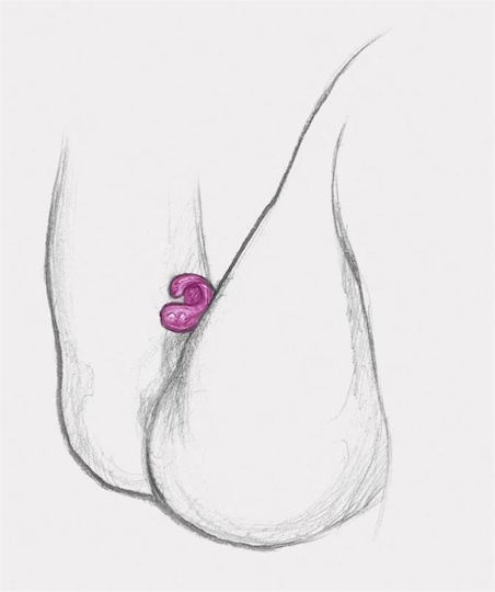 Fun Toys Gring Xl Finger Vibrator Sweet Raspberry Δονητής Δακτύλου Μωβ