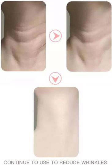 Andowl Neck Beauty Dispozitiv de terapie cu lumină Facial LED pentru Anti-Îmbătrânire Q-MJ10
