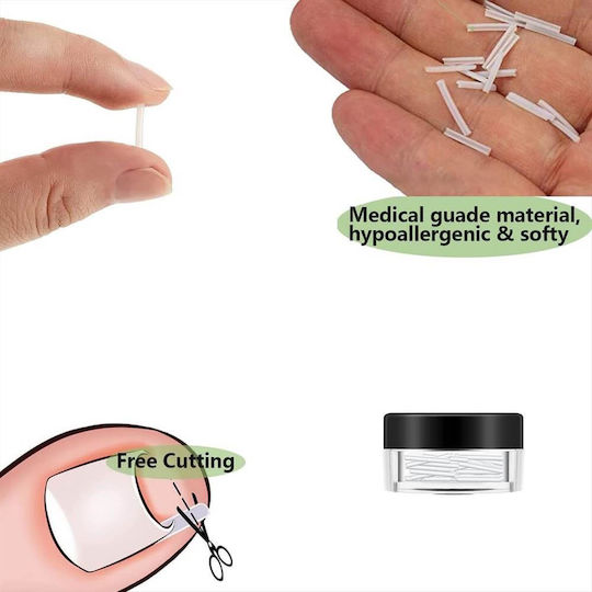 Ingrown Toenail Correction Liner Splint