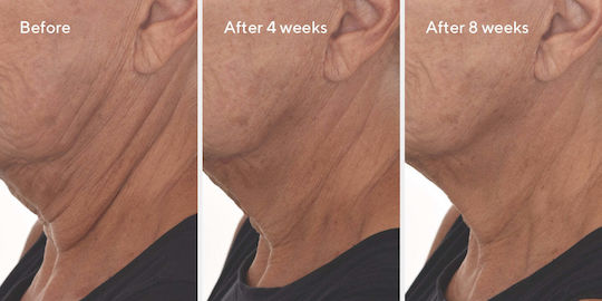 Murad Retinal Resculpt Overnight Treatment Ενυδατική & Αναπλαστική Κρέμα Προσώπου Νυκτός με Ρετινάλη 30ml