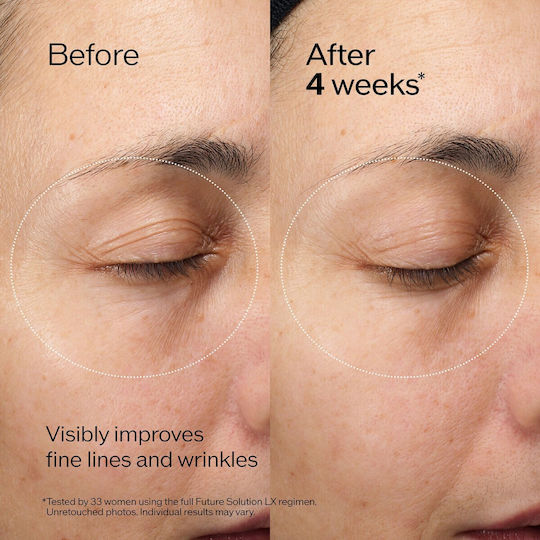 Shiseido Future Solution LX Κρέμα Ματιών & Χειλιών για Ανάπλαση , Αντιγήρανση , Μαύροι Κύκλοι & Ενυδάτωση 17ml