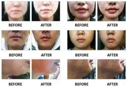Elastic V Face Lifting Mask