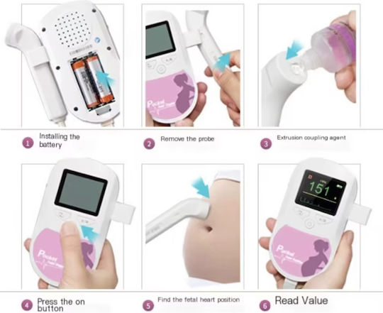 Contec Baby Sound C1 Gynecological Doppler