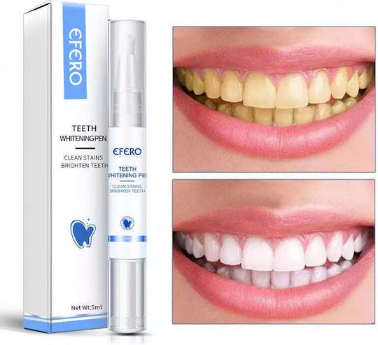 Teeth Whitening Kit with Pen & Device 5ml