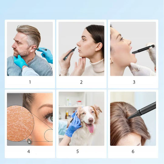 Ear Cleaning Device Otoscope Newevo Full Hd Camera 1080p 7-piece Earwax Removal Tool Kit 6 Led Lights Usb-c Charging Black
