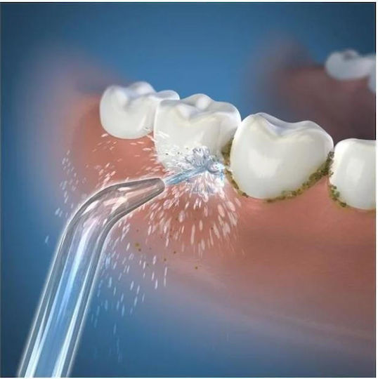 Waterpik Ανταλλακτικά για WTP-JT450 2τμχ