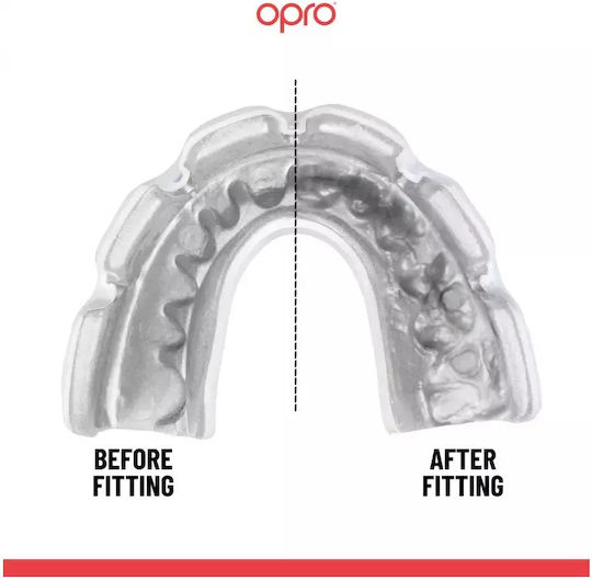 Opro Custom Fit Mouthguard Braces Under Orthodontic Appliance Black White