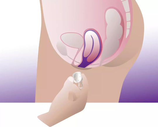 ProFem Cubeo Vaginal-Pessar 56mm 56mm