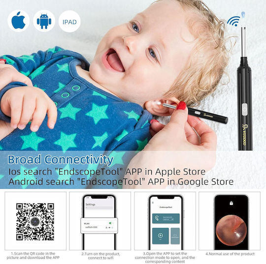 Dispozitiv Otoscop Wifi Îndepărtare Ceară Ureche Cameră 5 Mp Lumini Led Rezistent La Apă Ip67 Vizualizare Live Prin Aplicație Android Ios Negru
