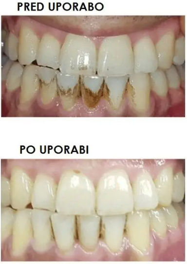 Silk'n ToothWave Ηλεκτρική Οδοντόβουρτσα με Αισθητήρα Πίεσης Λευκή