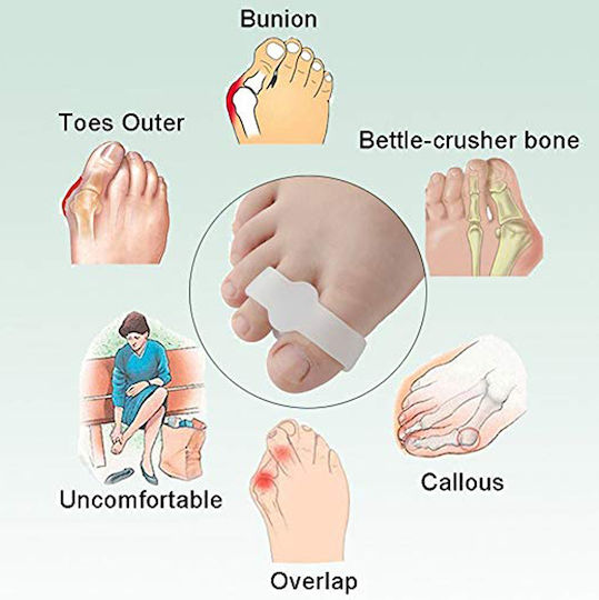 Set 2 Protectoare Pentru Bunion Separatoare De Degete Zenifique Silicon Albe