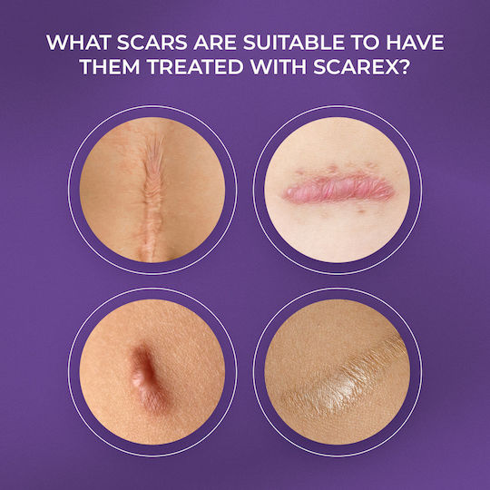 Biotrade Scarex Scar Removal Silicone Gel για Ουλές 15ml