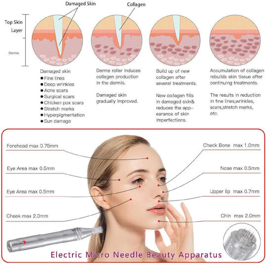 Facial Massage Device Συσκευή Microneedling για Καθαρισμό από Μαύρα Στίγματα X0010G0YR5