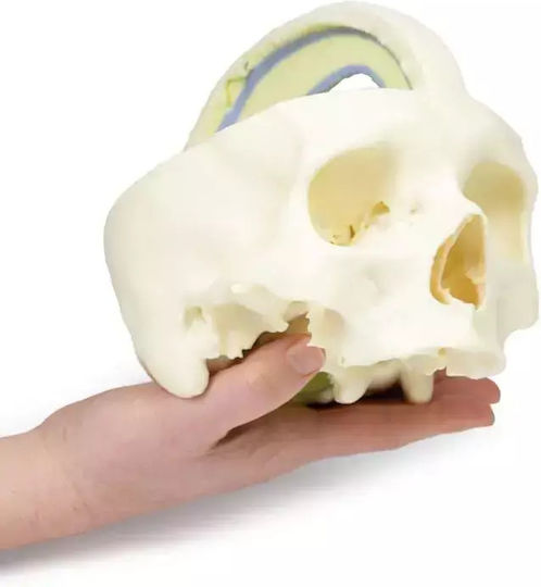 3D Schädel Harte Meningen Erler Zimmer