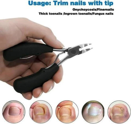 Nail Pro Medical Grade Nail Care Set for Thick or Ingrown Nails 5 Pieces