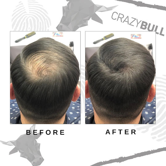 Hair Thinning Coverage Fibers Crazy Bull Hair Building Lightning Fibers Light Brown 22g