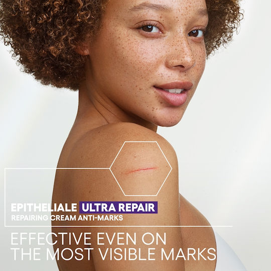 A-Derma Epitheliale A.H. Ultra Repair Ενυδατική Κρέμα Ανάπλασης με Υαλουρονικό Οξύ για Ξηρές & Ευαίσθητες Επιδερμίδες 100ml
