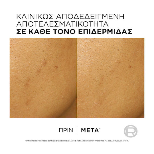 L'Oreal Paris Bright Reveal Feuchtigkeitsspendende und Anti-Aging Leichtgewichtige Gesichtscreme Tag mit SPF50 gegen Fehler und Akne mit Niacinamid und AHA 25ml