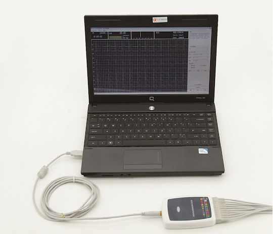 Contec Cardiographer 12-Channel