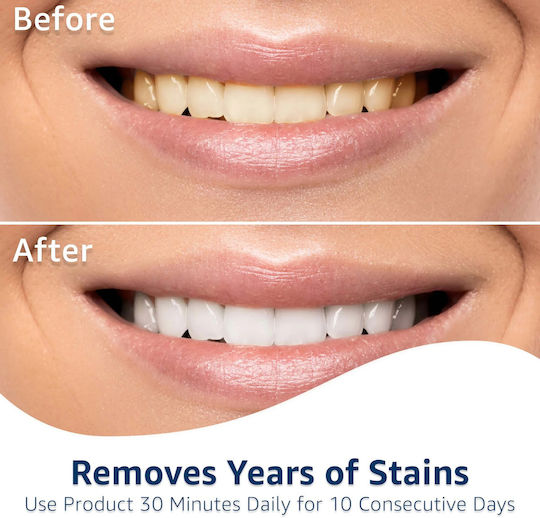 Box 10x Teeth Whitening Strips Equate Timeless White 10 Days Treatment