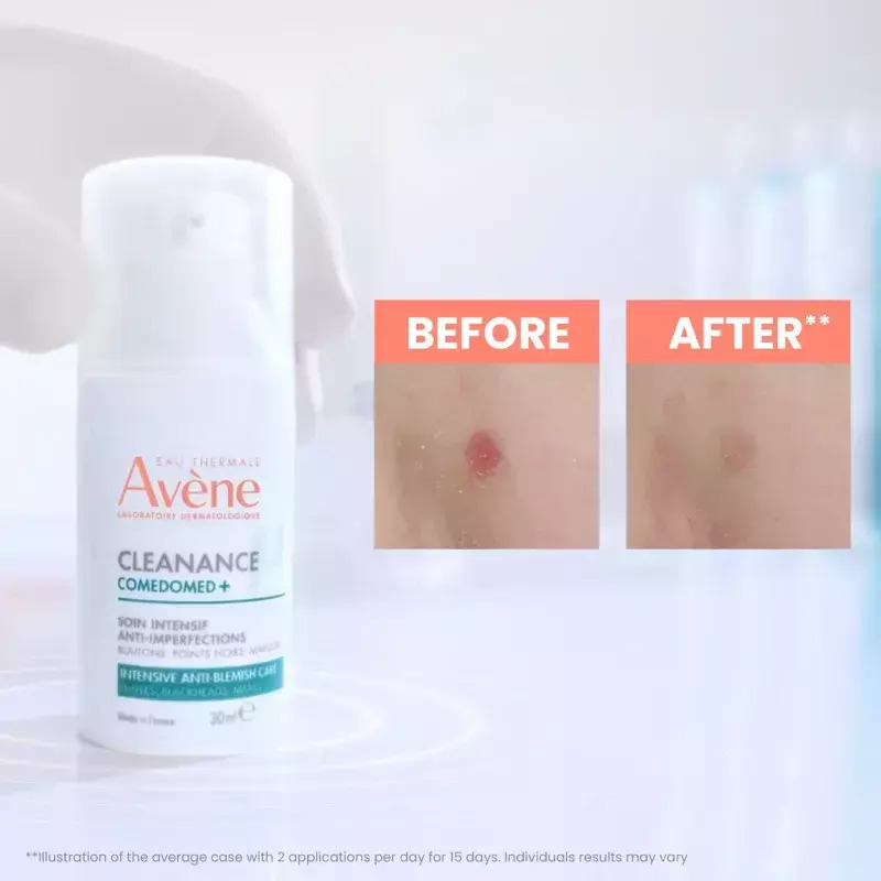 Eau Thermale Avène Cleanance Comedomed+ Light Ενυδατικό & Ρυθμιστικό Gel Προσώπου κατά των Ατελειών & της Ακμής με Νιασιναμίδη 30ml