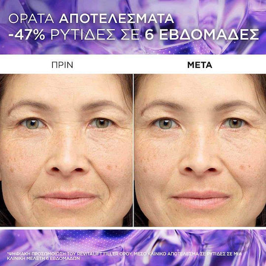 L'Oreal Paris Revitalift Filler 1.5% Ενυδατικό & Αντιγηραντικό Serum Προσώπου με Βιταμίνη C & Υαλουρονικό Οξύ για Λάμψη 30ml