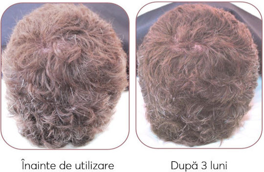 Ru:t hair Serum Pentru Scalp Împotriva Căderii Părului 100ml