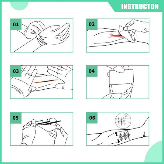 Rhino Rescue Surgical Accessory 2.5mm 1pcs