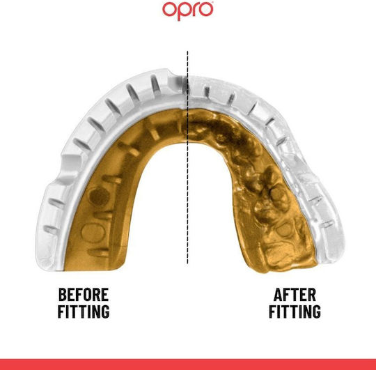Μασέλα Opro Gold Σιδεράκια White Gold