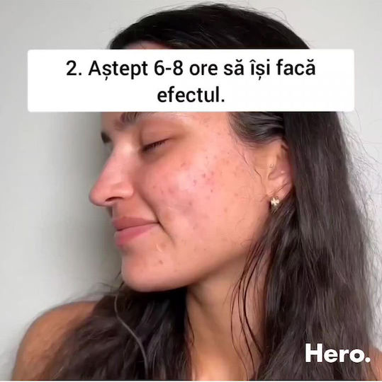 Hero Επιθέματα για Σπυράκια Mighty Patch Original 24τμχ