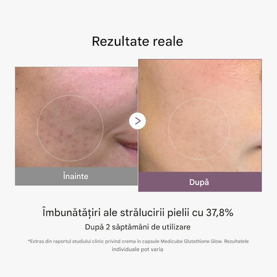 Medicube Capsule Rich Cremă Hidratantă și Anti-Îmbătrânire de Noapte pentru Față Împotriva Petelor Pigmentare cu Colagen și Peptide 50ml
