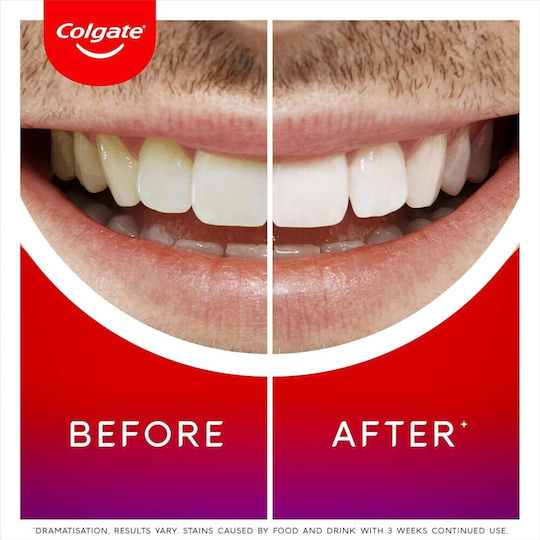 Colgate Teeth Whitening Toothpaste & Pen 2.5ml