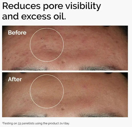 The Ordinary Niacinamide 10% + Zinc 1% Ενυδατικό Serum Προσώπου με Νιασιναμίδη για Λάμψη 60ml