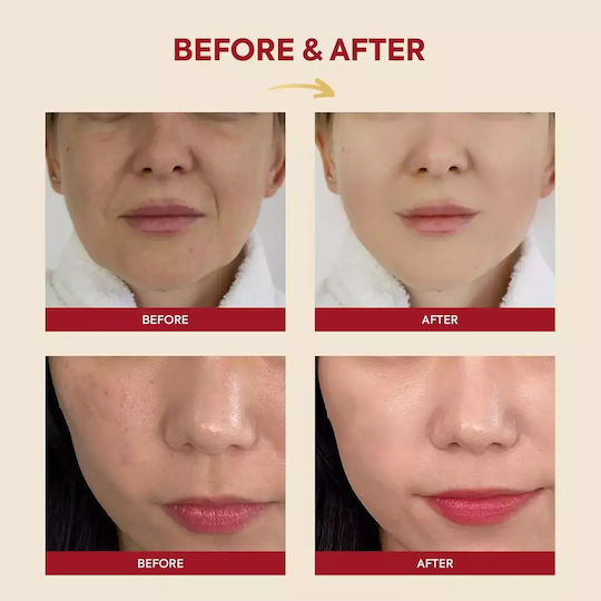 K-Secret Seoul 1988 Snail Mucin 97% + Rice Καταπραϋντικό & Ενυδατικό Essence Προσώπου με Έκκριμα Σαλιγκαριού & Υαλουρονικό Οξύ για Λάμψη & Ακμή 100ml