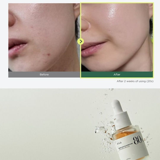 Anua Heartleaf 80% Soothing Ampoule Anti-aging Essence Face with Hyaluronic Acid & Vitamin B5 30ml
