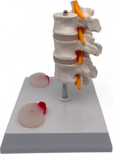 Oem Lumbar Spine Medical Training Manikin 17cm White