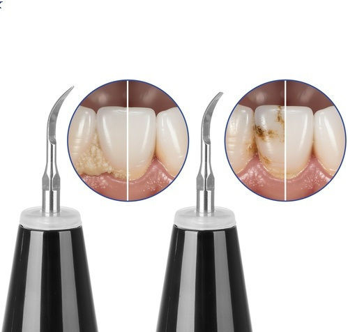 Ultrasonic Ηλεκτρική Οδοντόβουρτσα Μαύρη