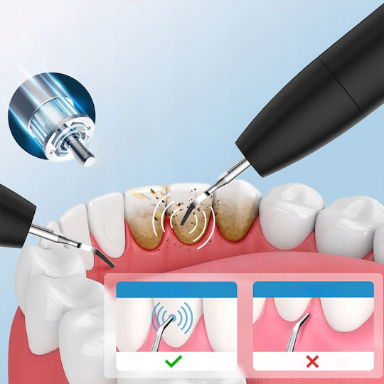 Ultrasonic Tooth Scaler Tartar Removal Dental Led