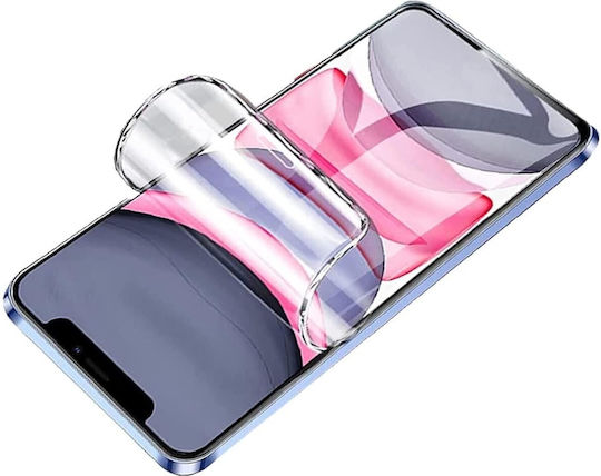 Infinity Enterprise Hydrogel Screen Protector (Xiaomi 17)