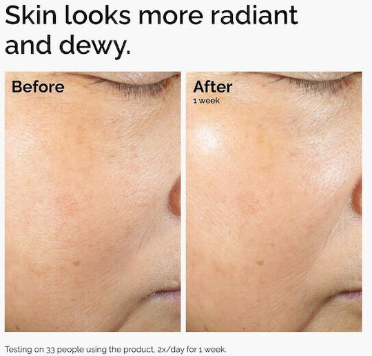 The Ordinary Rise Lipids & Ectoin Microemulsion Light Ενυδατικό Γαλάκτωμα Προσώπου κατά της Ερυθρότητας με Ρύζι