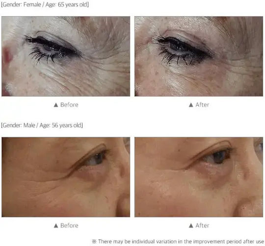 Dermafirm Akne Tagesgesichtscreme 50ml