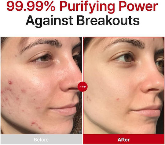 Purito Helan Gesichtsspray Tonisierung Gesichtswasser 100ml