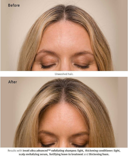 Aveda Invati Conditioner κατά της Τριχόπτωσης για Λεπτά Μαλλιά 200ml