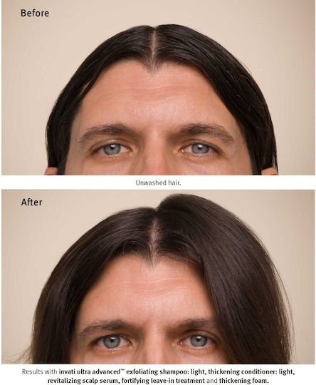Aveda Invati Conditioner κατά της Τριχόπτωσης για Λεπτά Μαλλιά 200ml