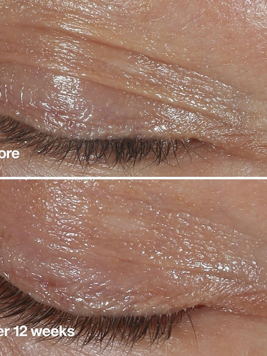 Clinique De-Aging Experts Kosmetik-Set Hautpflege-Set für Anti-Aging