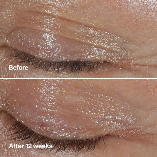 Clinique De-aging Experts Cosmetic Set Σετ Περιποίησης για Αντιγήρανση