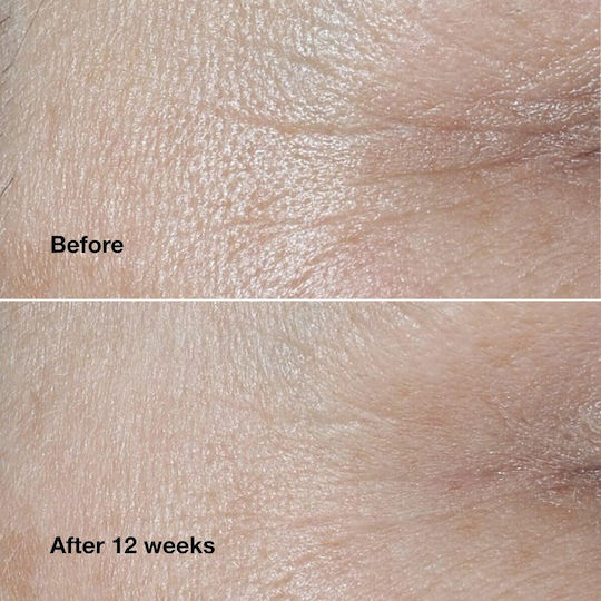 Clinique De-aging Experts Cosmetic Set Σετ Περιποίησης για Αντιγήρανση