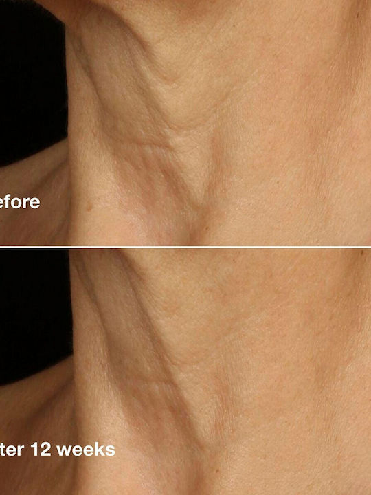 Clinique Lift+Smooth Routine Set Îngrijire pentru Anti-îmbătrânire & Tonifiere 4 bucăți