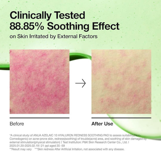Anua Azelaic 10 Hyaluron Facial Toner Pads with Centella Asiatica Ceramides and Panthenol 90 Pieces