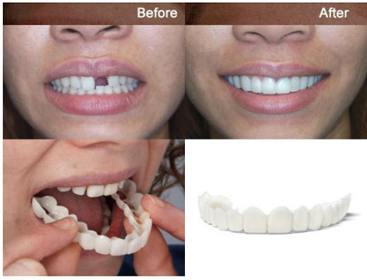 Smile 2τμχ 3784